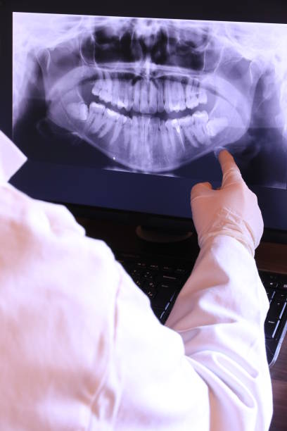Best Emergency Gum Treatment in Roscoe, TX
