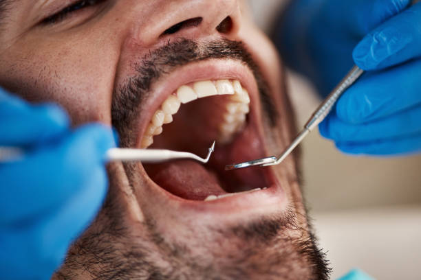 Best Cosmetic Emergency Dentistry in Roscoe, TX