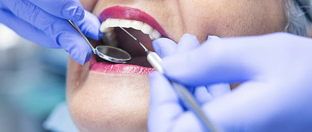 Best Emergency Dental Care for Broken or Chipped Teeth in Roscoe, TX